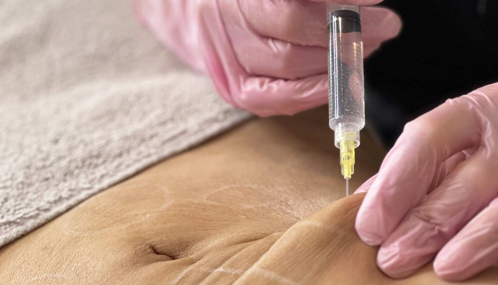 MorySkin empfiehlt pb serum – Exklusive Wirkstoffkombinationen